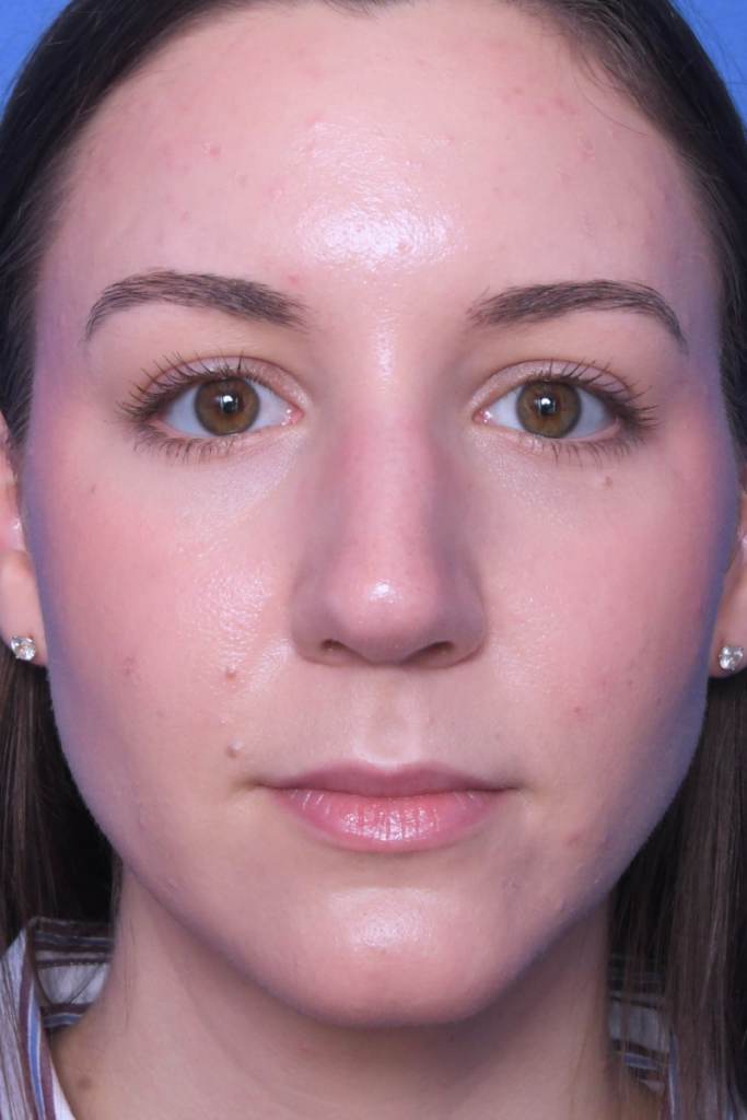 After
