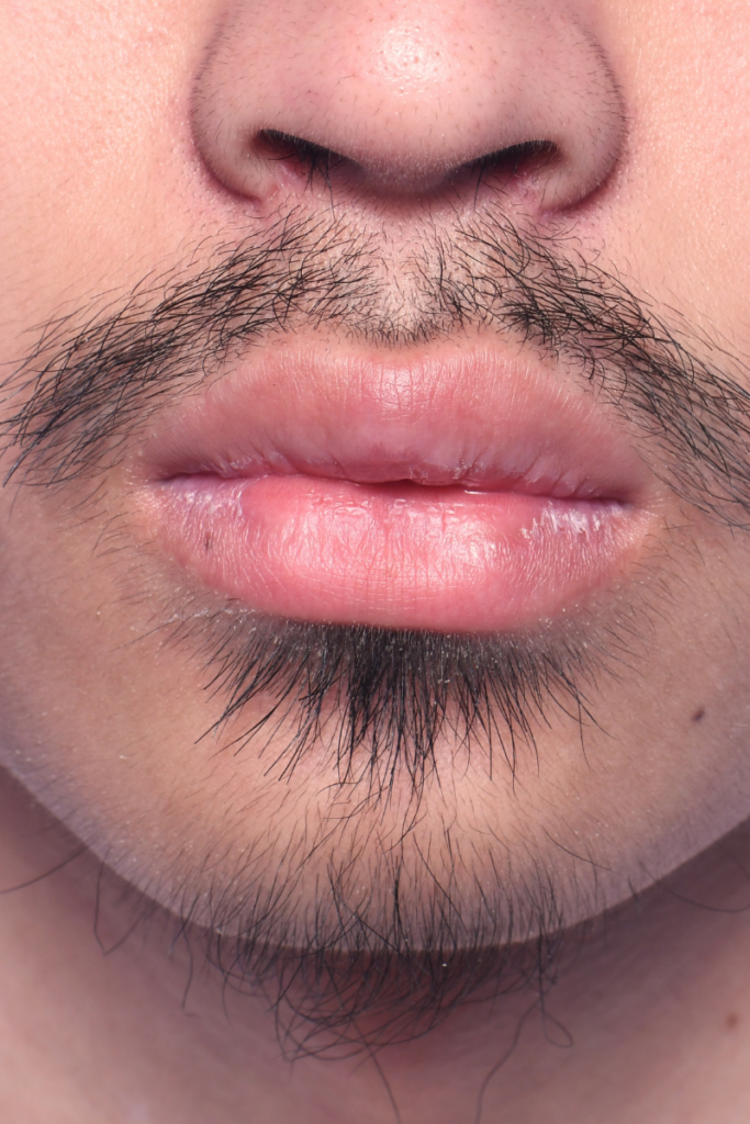 Before