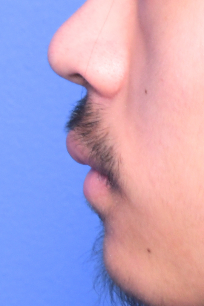 After