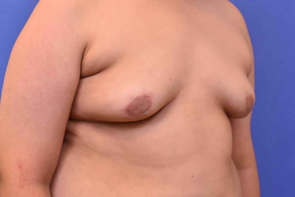 After